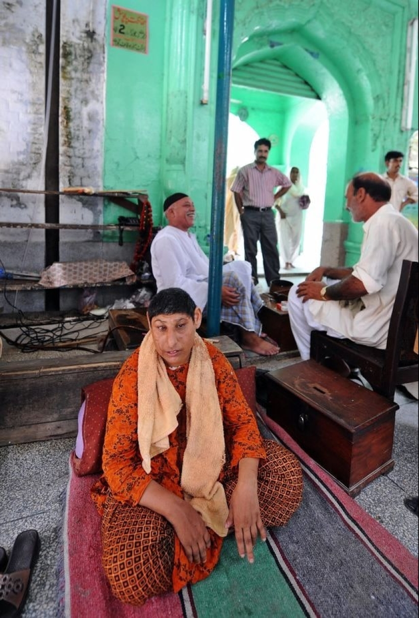 "Rats of Shah Daula": children from Pakistan with deformed skulls and a hard fate