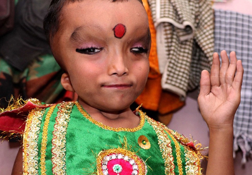 Residents of an Indian village worship a boy with a deformed head as the god Ganesha