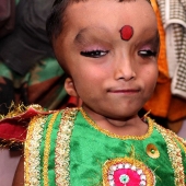 Residents of an Indian village worship a boy with a deformed head as the god Ganesha