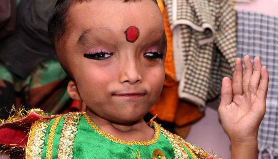 Residents of an Indian village worship a boy with a deformed head as the god Ganesha