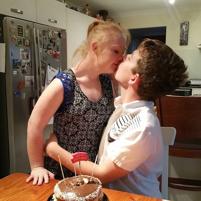 Romantic photos of Down syndrome model Madeleine Stewart and her boyfriend