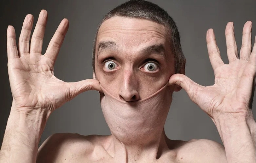 Rubber Face: how Harry Turner, the man with the most elastic skin in the world, lives