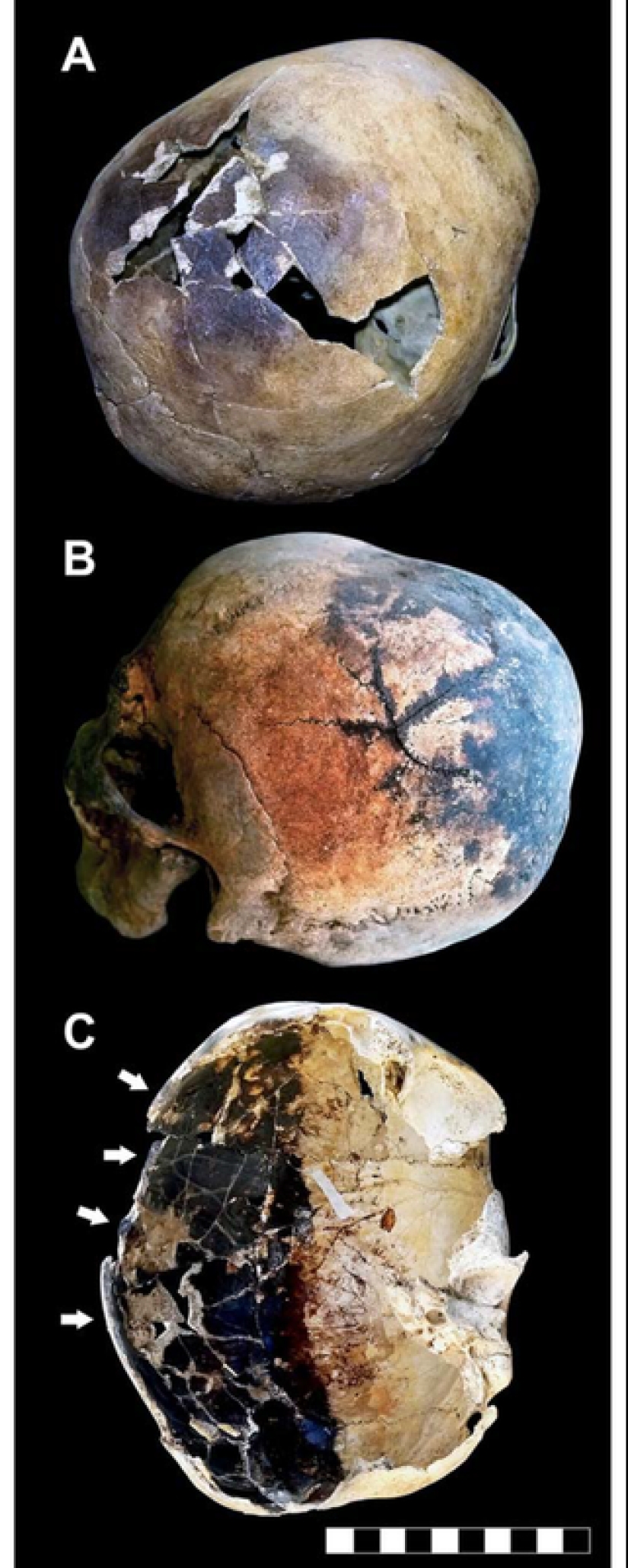 Screams of pain and boiling blood: archaeologists told how the inhabitants of Pompeii died