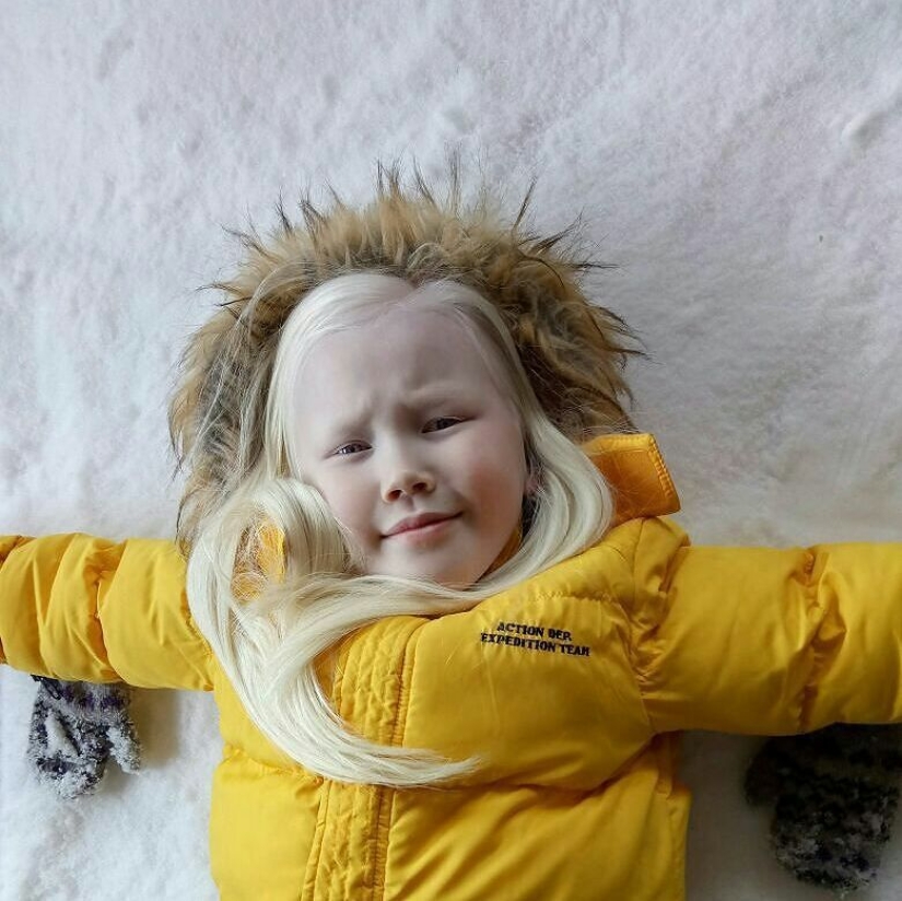 Snow White from Siberia: 8-year-old model with the rarest appearance shocked the Internet