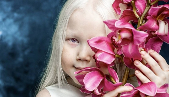 Snow White from Siberia: 8-year-old model with the rarest appearance shocked the Internet