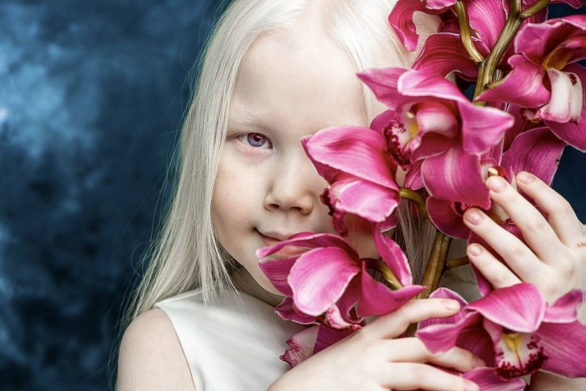 Snow White from Siberia: 8-year-old model with the rarest appearance shocked the Internet