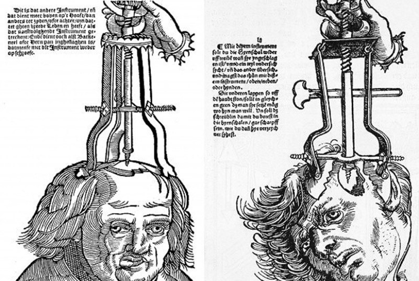 Strange medical procedures that were considered healing in the past