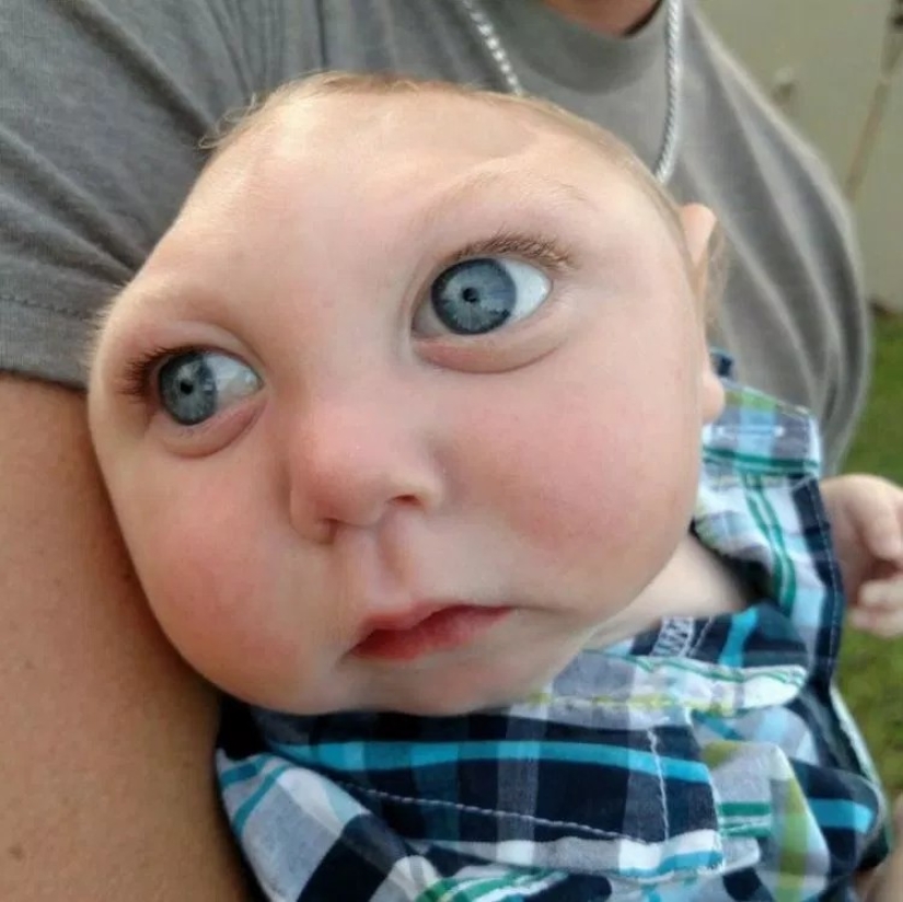 The Amazing Story of Baby Jackson, the Boy Who Lived