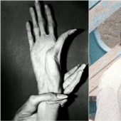 The Beast in human flesh: the creepy story of a Japanese maniac with vampire hands