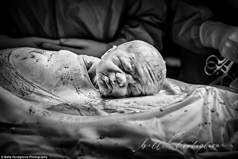 The best works of the winners of the contest of photographers taking pictures of childbirth