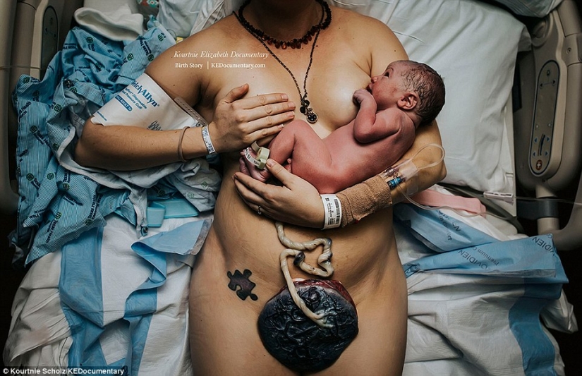 The best works of the winners of the contest of photographers taking pictures of childbirth