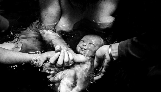 The best works of the winners of the contest of photographers taking pictures of childbirth