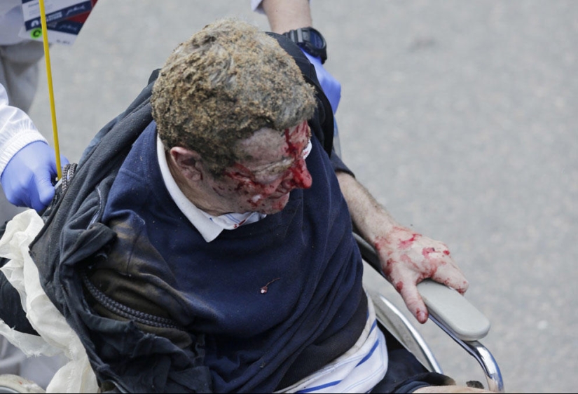 The Boston Marathon bombing is the first terrorist attack in the United States since 9/11