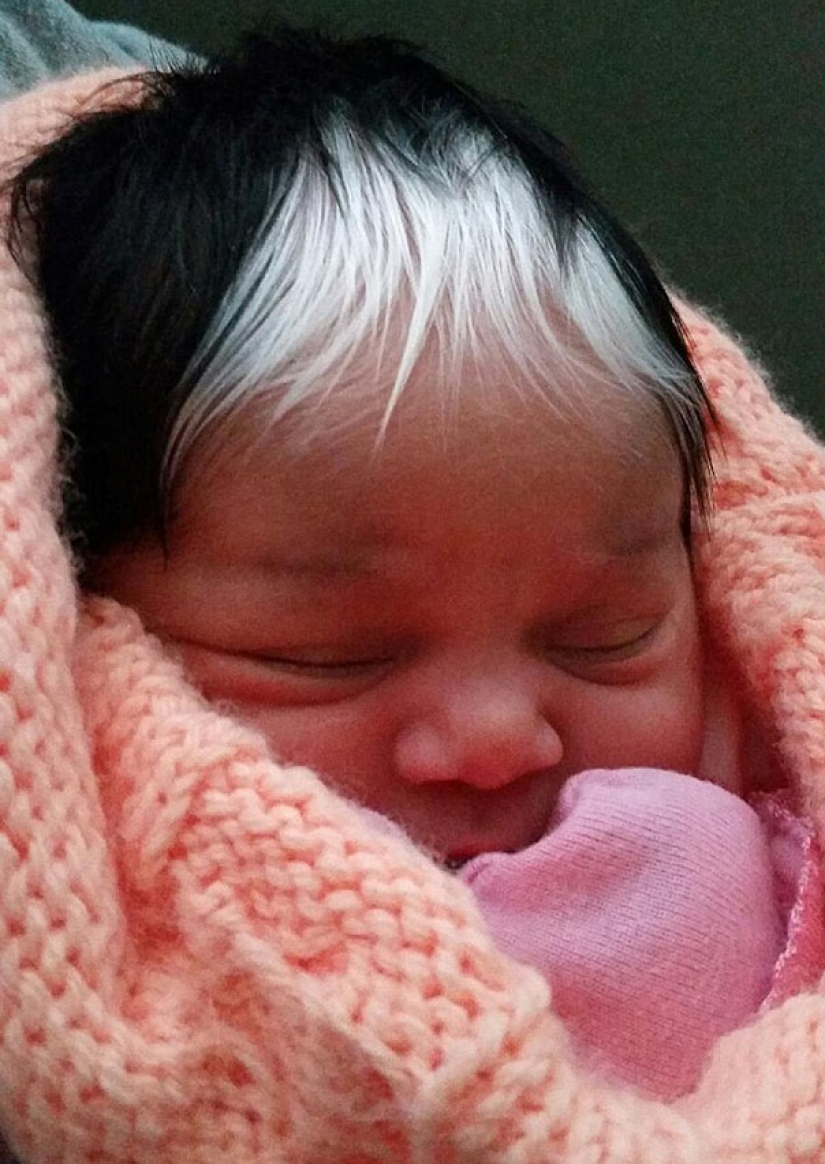 The girl was born with white bangs, exactly the same as her mother, grandmother and great-grandmother