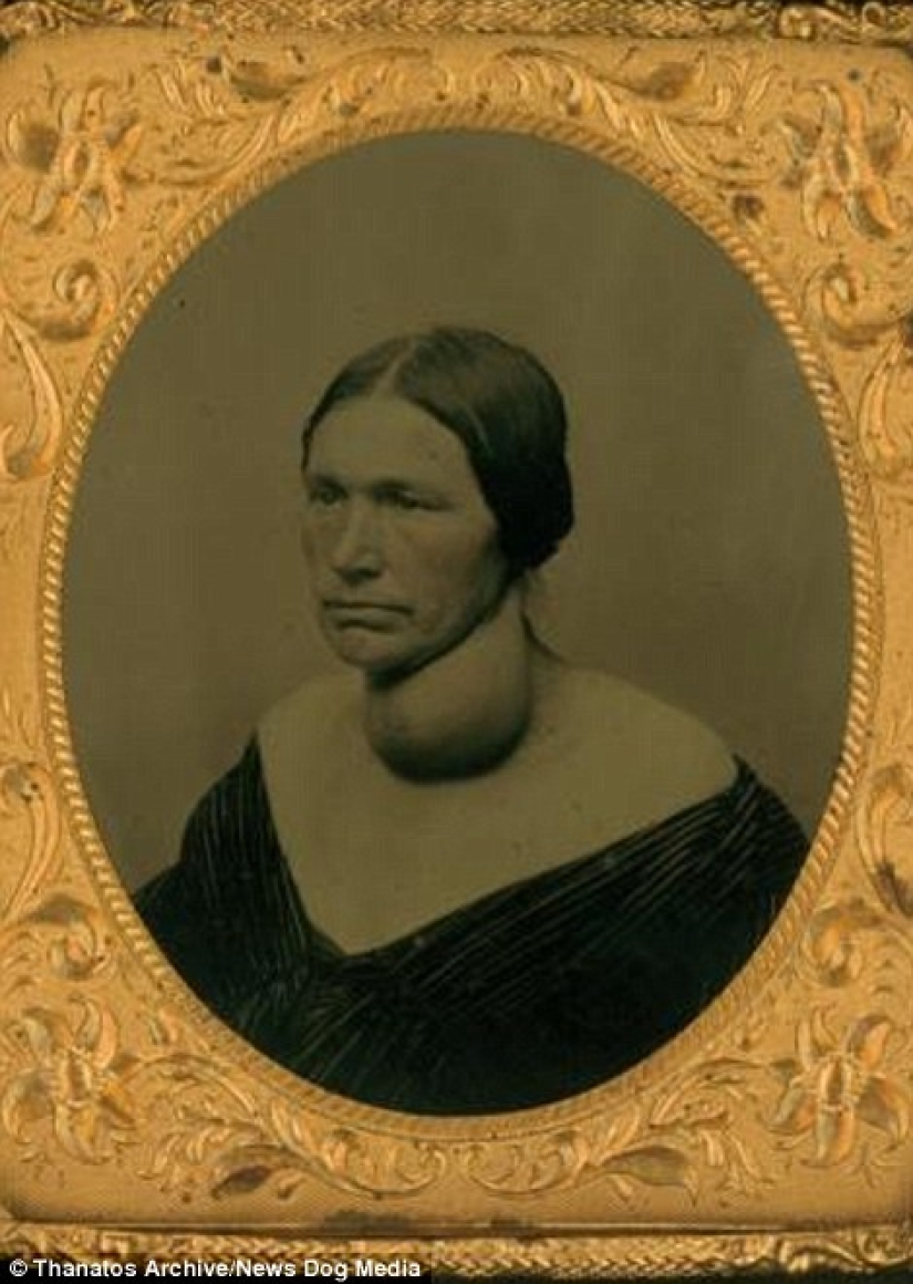 The harsh XIX century: a collection of archival photographs of people with deformities