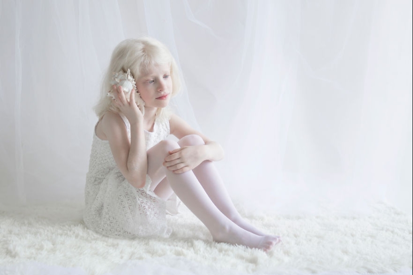 The hypnotic beauty of albinos in the photo project of Yulia Taits
