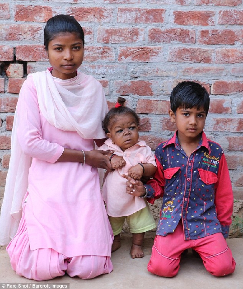 The inexplicable story of a 21-year-old Indian who got stuck in the body of a baby