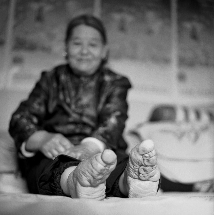 The last living Chinese women with lotus feet