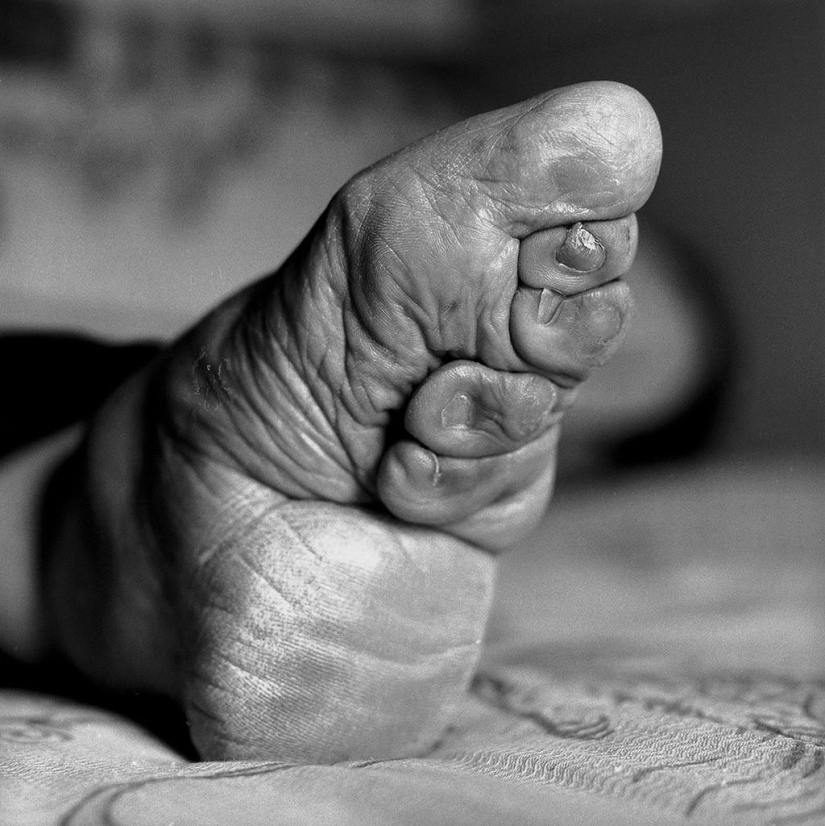 The last living Chinese women with lotus feet