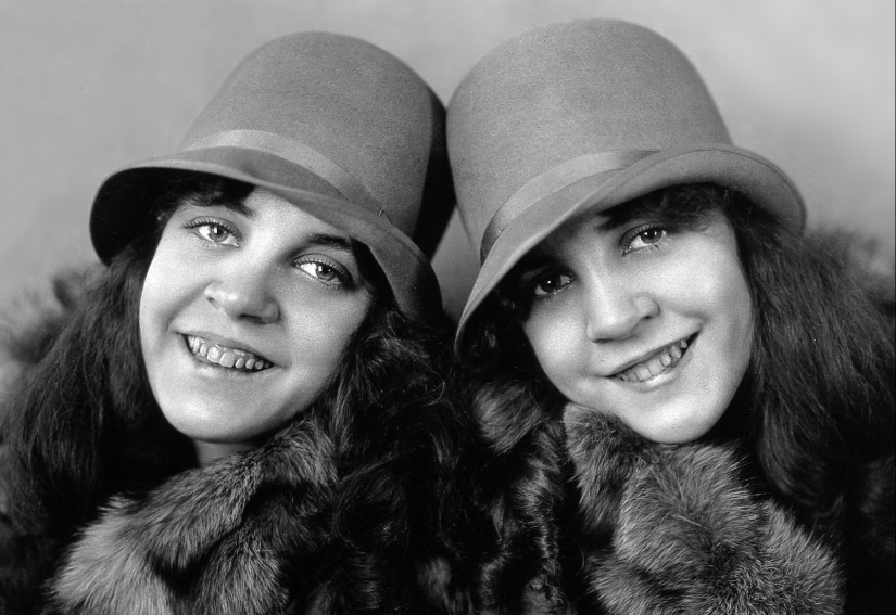 The life of Siamese twins Daisy and Violet Hilton