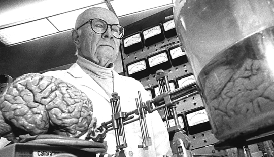 The story of a head transplant that was never meant to happen