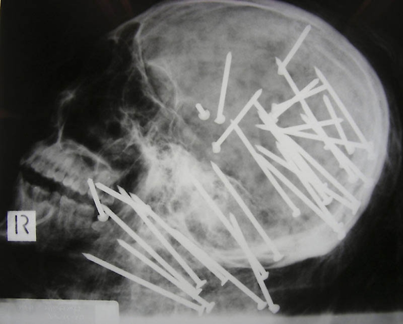 The strangest X-rays