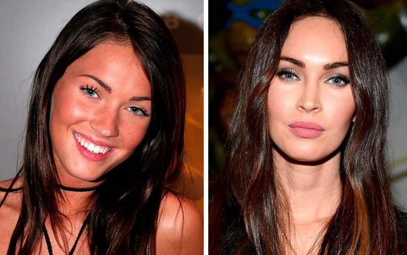 The surgeon did a great job: 10 stars with perfect facial plastic surgery