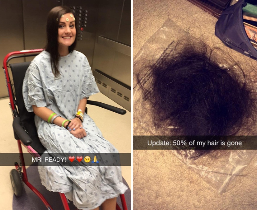 The teenager shaved his head in solidarity with his girlfriend with cancer