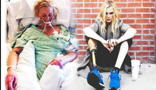 The tragic story of Lauren Wasser, who lost her legs after using tampons