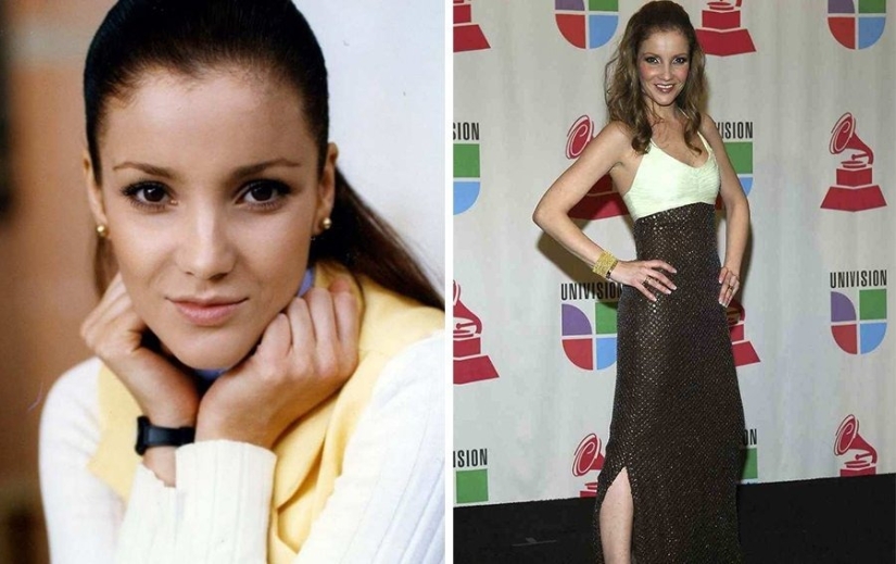 They were afraid to get fat: 9 stars who were ruined by anorexia