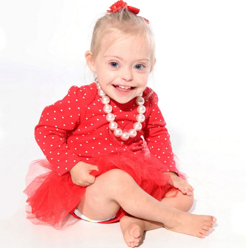 Two-year-old girl with Down syndrome became a model thanks to her radiant smile