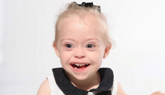 Two-year-old girl with Down syndrome became a model thanks to her radiant smile Two-year-old girl with Down syndrome became a model thanks to her radiant smile