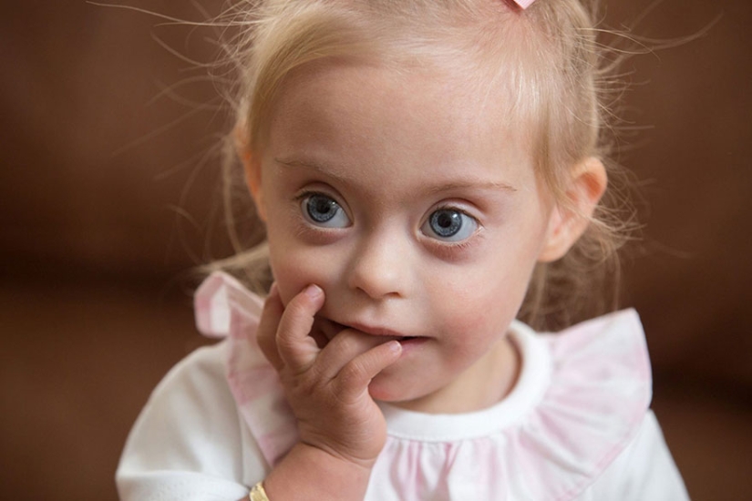 Two-year-old girl with Down syndrome became a model thanks to her radiant smile