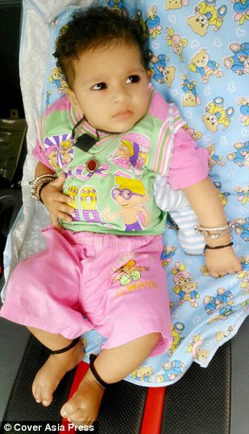 Un bebé de dos años de la India sufre pubertad prematura