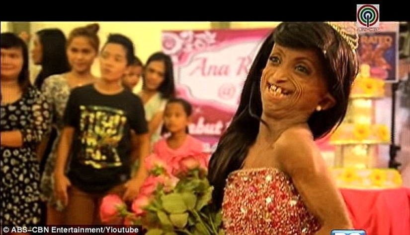 Una niña con el cuerpo de una mujer de 150 años murió en Filipinas