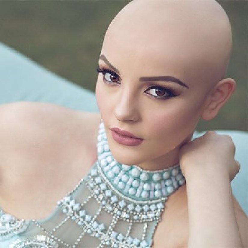 Una niña de 17 años que lucha contra el cáncer protagonizó una atrevida sesión de fotos sin peluca