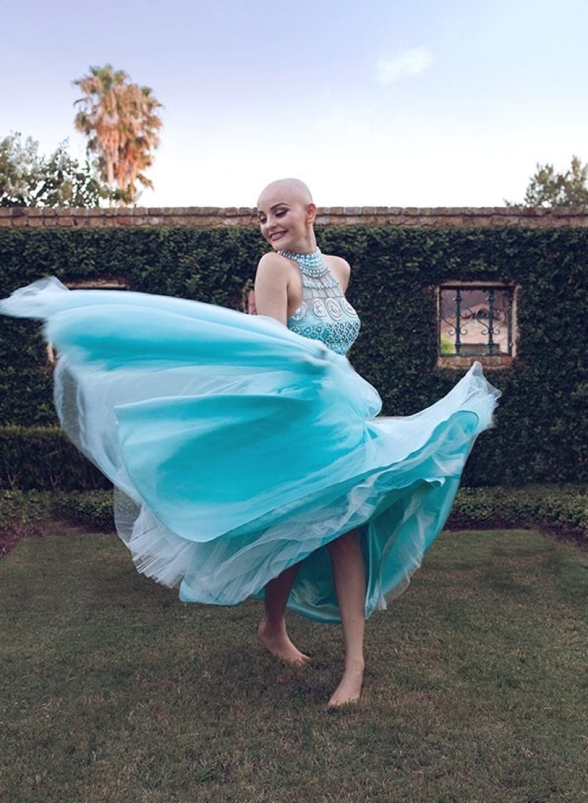 Una niña de 17 años que lucha contra el cáncer protagonizó una atrevida sesión de fotos sin peluca