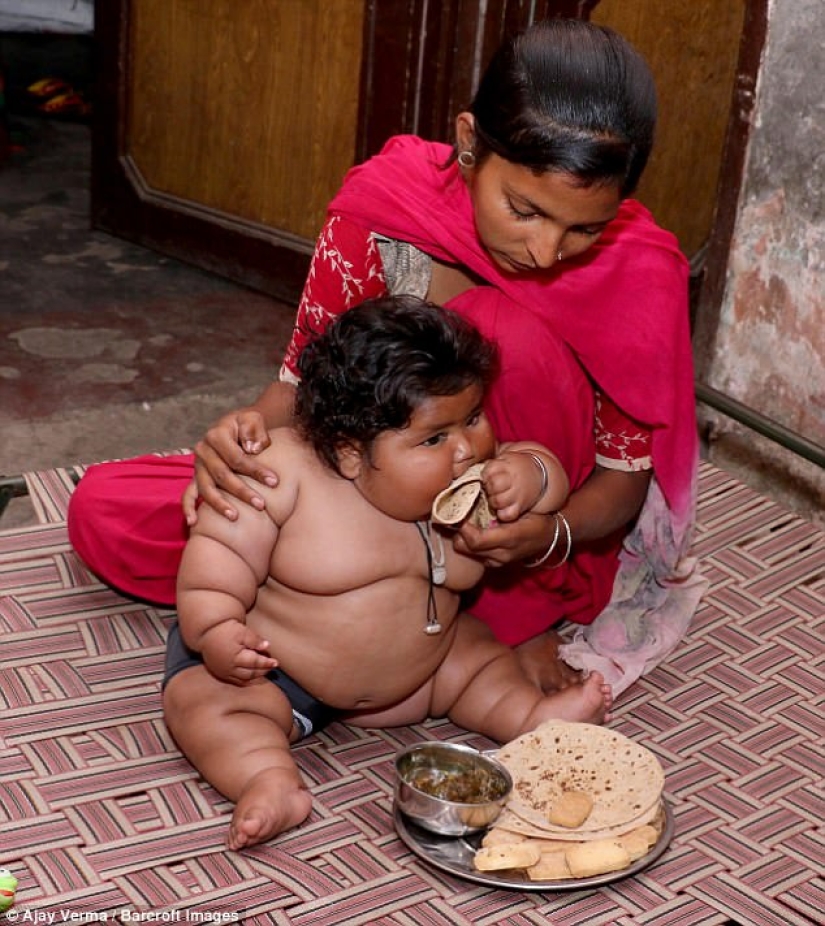 Una niña de 8 meses pesa 17 kilogramos y los médicos no pueden diagnosticarla