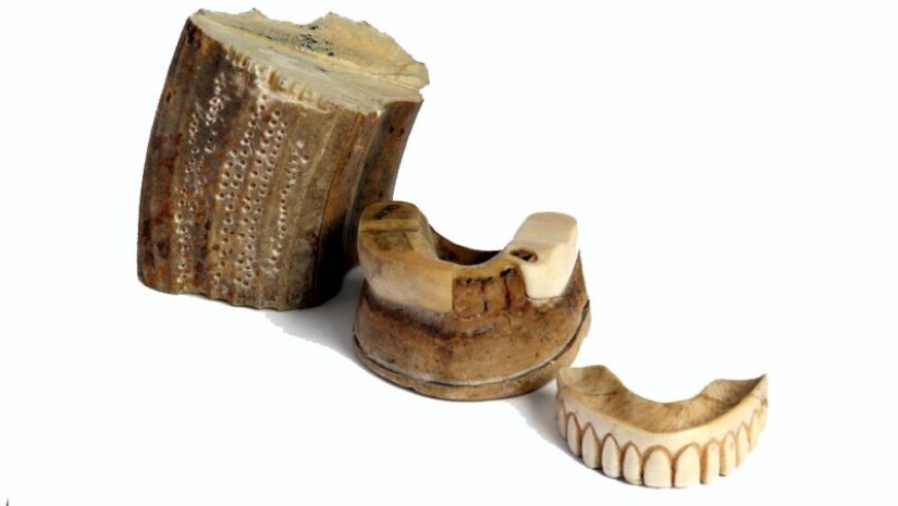 What is "Waterloo teeth", or As the battle of 1815 influenced the development of dentistry