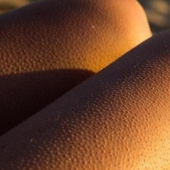 Where do goosebumps come from and why do we need them