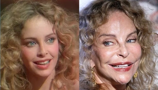 With age, their beauty came to naught: 10 transformations of stars