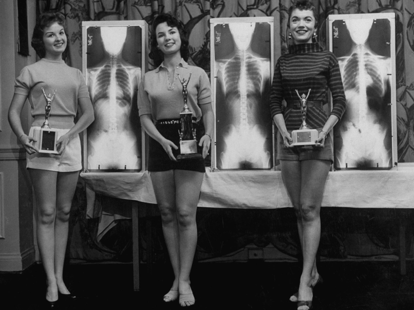 X-ray, plumb and weights: how to choose "Miss correct posture" in the 50s