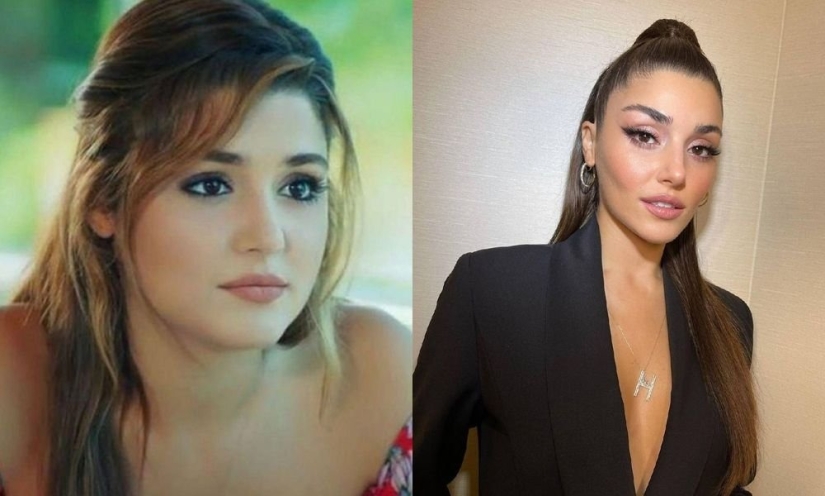 Yours or plastic? All plastic surgeries of Turkish beauty Hande Ercel