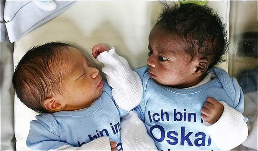 10 incredible true stories about twins