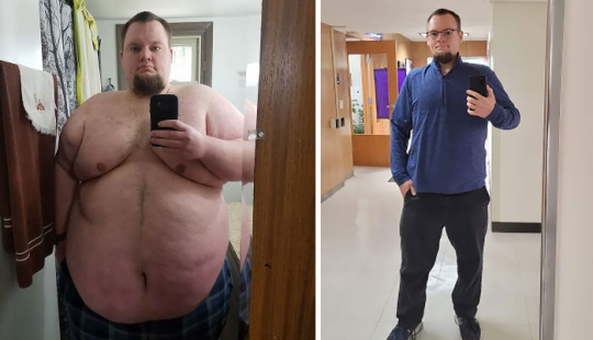 10 Times People Surprised Everyone By Losing So Much Weight They Looked Like A Different Person