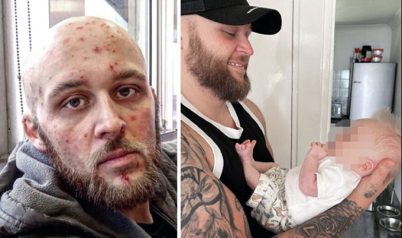 11 Before And After Pictures That Show What Happens When People Overcome Addiction