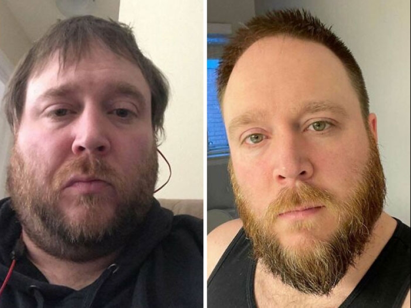 11 Before And After Pictures That Show What Happens When People Overcome Addiction