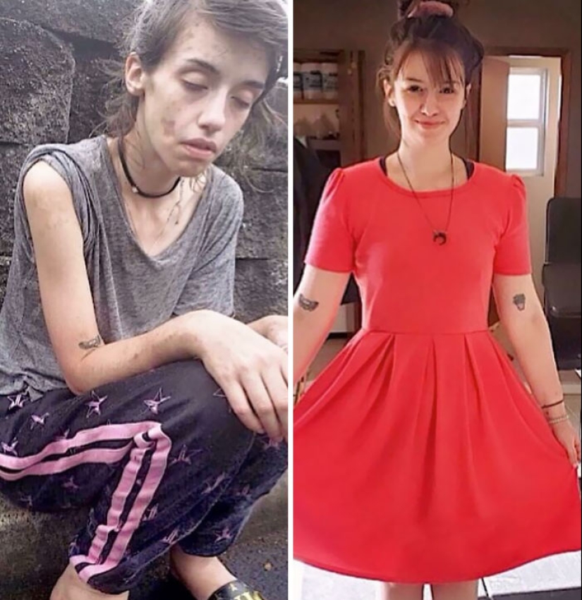 11 imágenes de antes y después que muestran lo que sucede cuando las personas superan la adicción