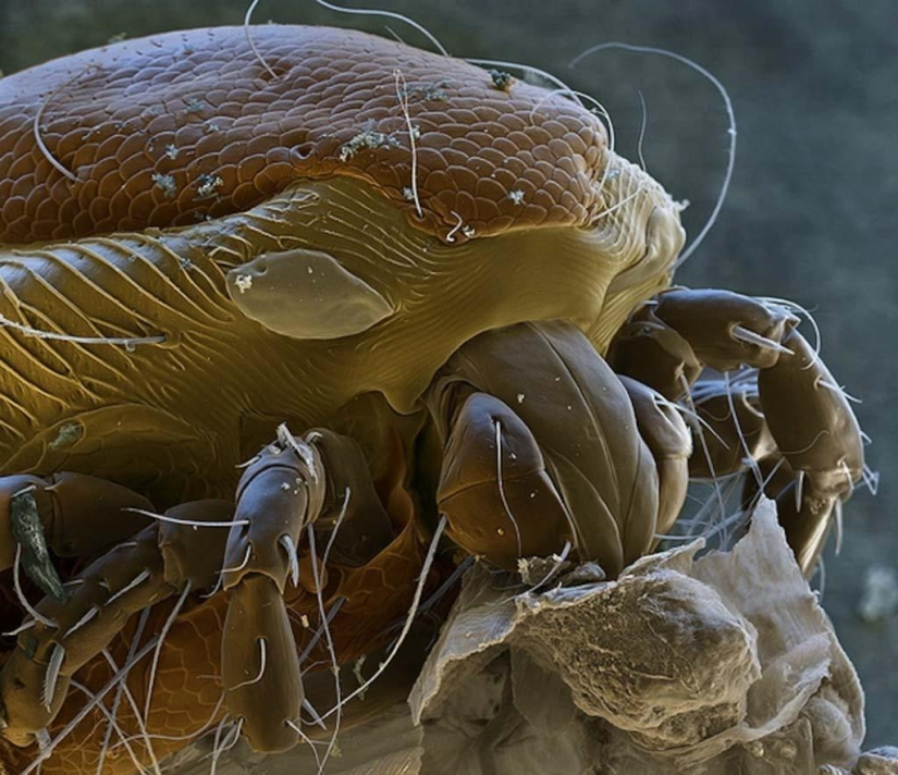 15 amazing creatures that can't be seen without a microscope