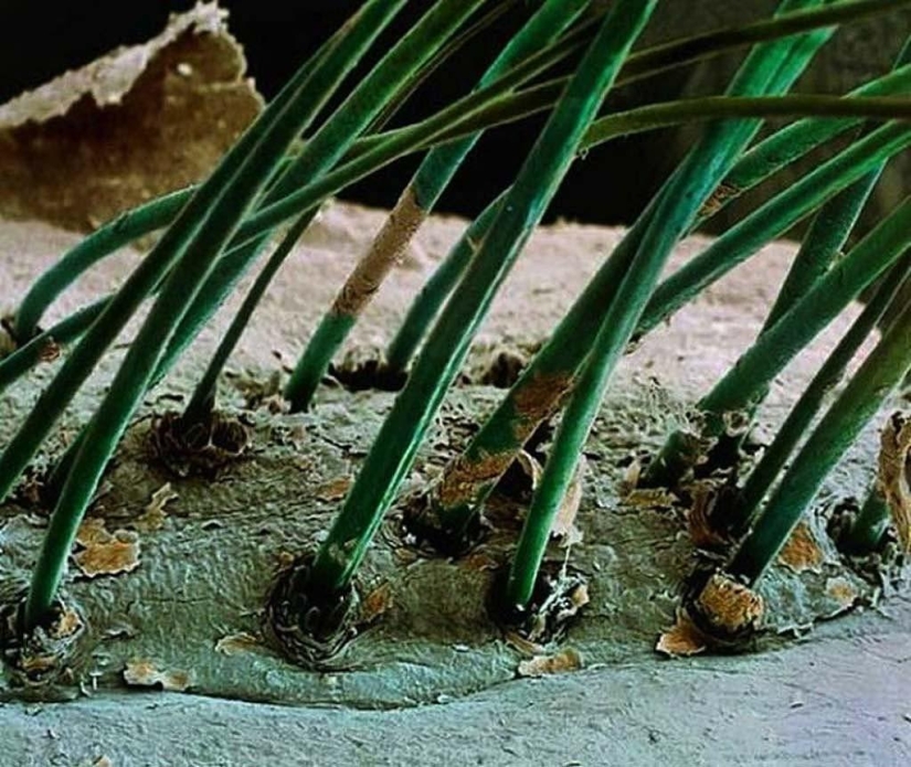 15 criaturas asombrosas que no se pueden ver sin un microscopio